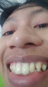 Kryxee
